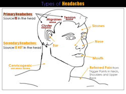 Headaches